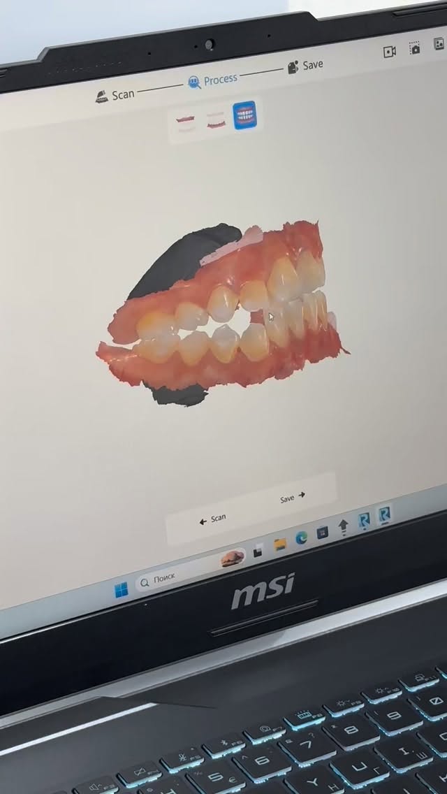 Внутриоральный 3D-сканер